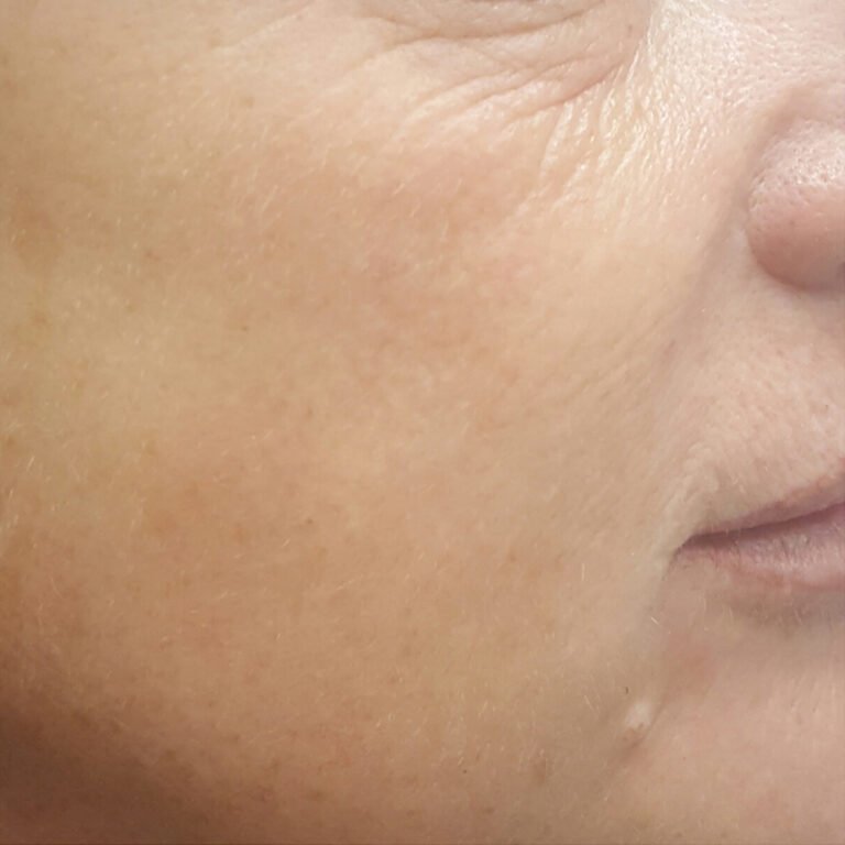 bioristrutturanti 1post